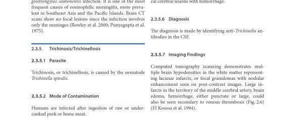  Unlocking the Secrets of Disease Diagnosis with PET and SPECT Imaging: A Comprehensive Guide to Advanced Medical Imaging Techniques